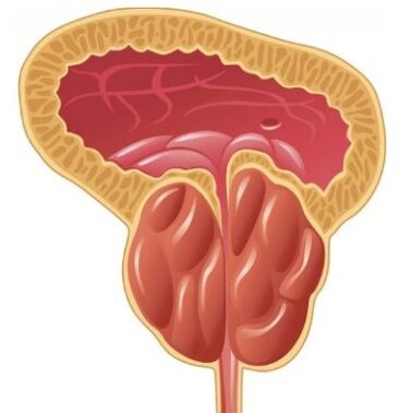 Prostate inflammation